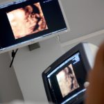 Stawiając na osobisty rozwój i niezależność musimy być trzeźwi, z wszystkich pozytywów i minusów wynikających….